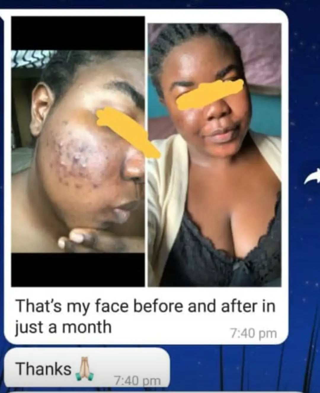Acne Face Kit